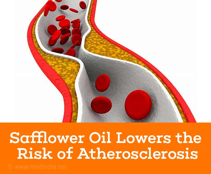 Safflower Oil Lowers the Risk of Atherosclerosis Safflower Oil Lowers the Risk of Atherosclerosis